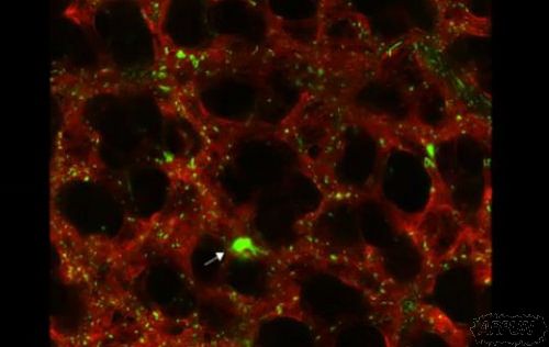 ��ѧ�ҷ��ַε��¹���: ��Ѫ��