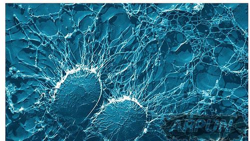 科学家获准研究如何用干细胞救回活死人!