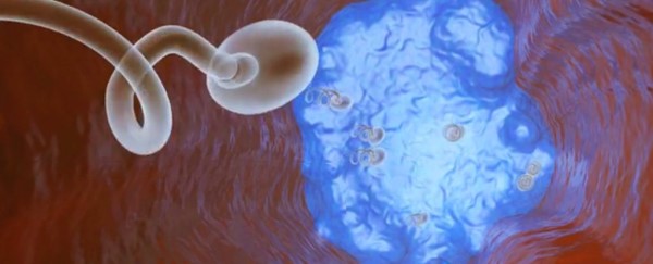 男性避孕新发现,一针能管好几年