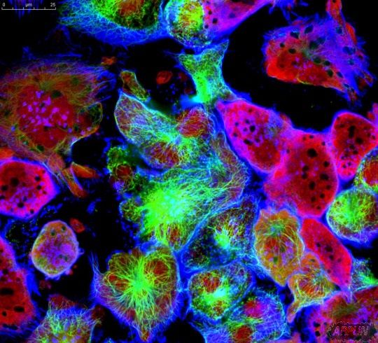 ��ѧ���ҵ��ð�ϸ����ɱ�ķ����ˣ�