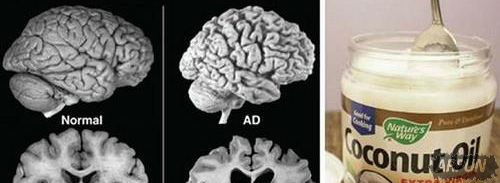 ҽ����Ҭ�����������Ϲ��İ��Ⱥ�Ĭ֢���־��˵�Ч����