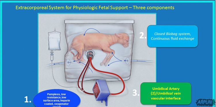 医学大突破: 科学家成功利用人造子宫生长小羊!