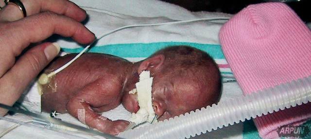 医学大突破: 科学家成功利用人造子宫生长小羊!