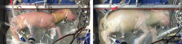 医学大突破: 科学家成功利用人造子宫生长小羊!