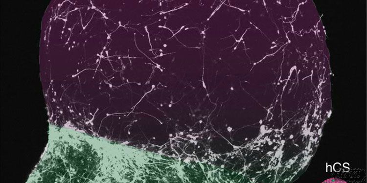 科学家在实验室里培养出可运作的人脑!