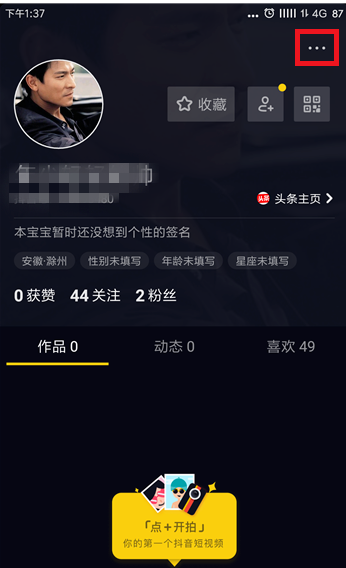 �ϴ��˶�����Ƶ����ʧ����ô�죿