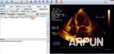 合肥翔翼超声影像工作站